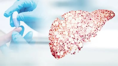 Using Epigenetic Immunophenotyping to Explore Potential Biomarkers in Hepatocellular Carcinoma